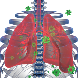 型冠状病毒 肺炎防疫肺炎 3d 立体 健康的 病发 骨架 x-ray
